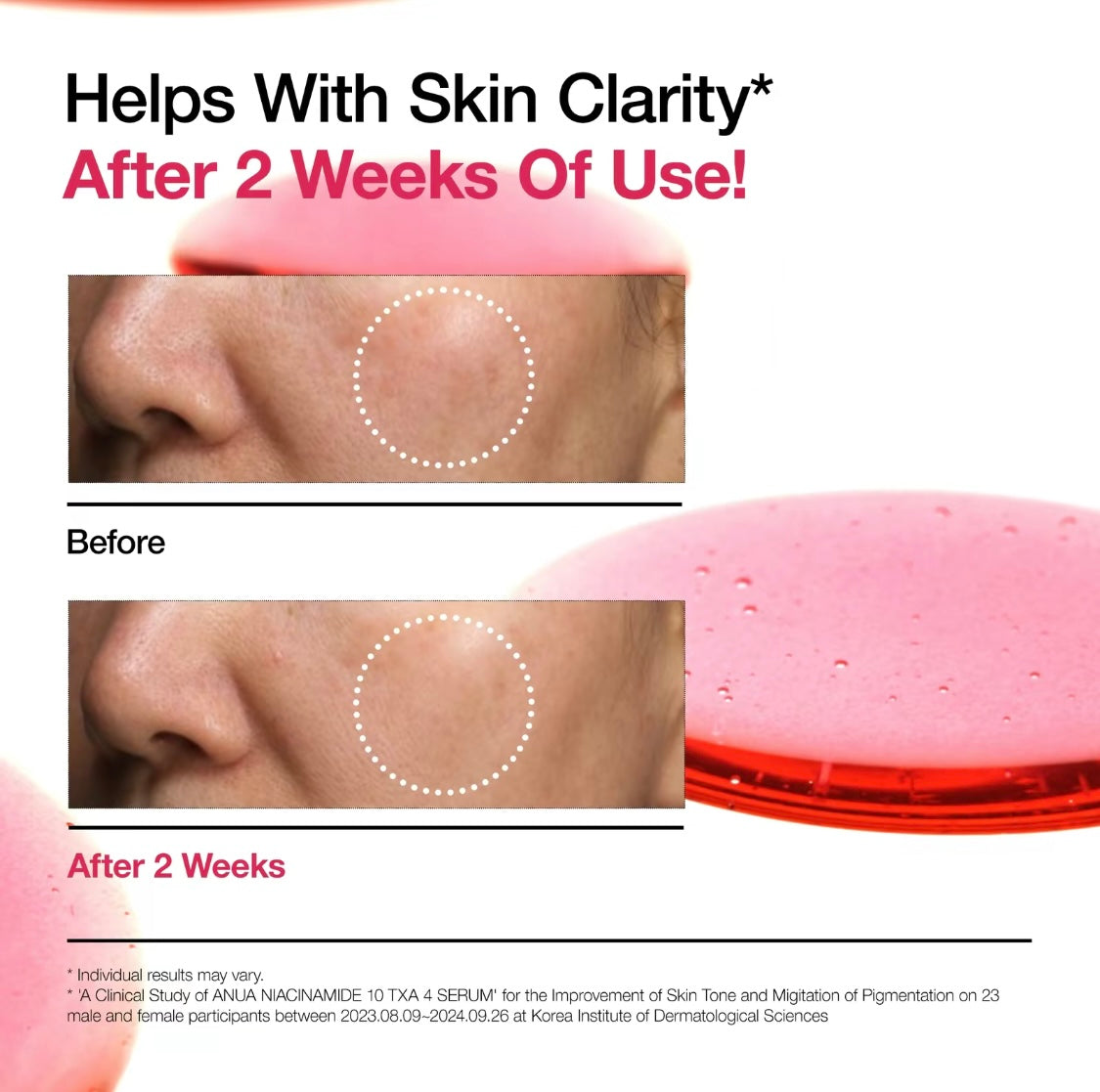 Niacinamide 10% + TXA 4% Treatment Serum