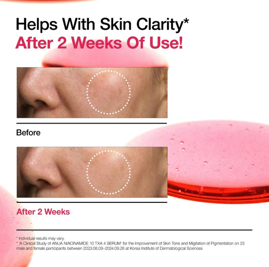 Niacinamide 10% + TXA 4% Treatment Serum